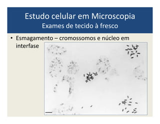Estudo celular em Microscopia
Exames de tecido à fresco
• Esmagamento – cromossomos e núcleo em
interfase
 