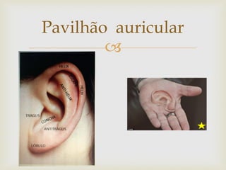 
Pavilhão auricular
 