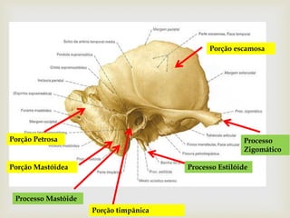 Processo
Zigomático
Processo Estilóide
Porção escamosa
Processo Mastóide
Porção timpânica
Porção Mastóidea
Porção Petrosa
 