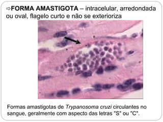 FORMA AMASTIGOTA – intracelular, arredondada
ou oval, flagelo curto e não se exterioriza
Formas amastigotas de Trypanosoma cruzi circulantes no
sangue, geralmente com aspecto das letras "S" ou "C".
A forma amastigota: é a forma de reprodução do protozoário, reprodução assexuada por
divisao binária.
 