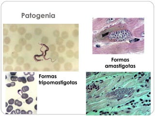 Formas
tripomastigotas
Formas
amastigotas
Patogenia
 