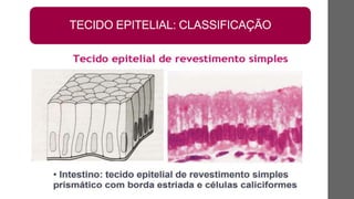 TECIDO EPITELIAL: CLASSIFICAÇÃO
 