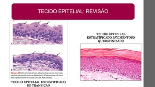 TECIDO EPITELIAL
ESTRATIFICADO PAVIMENTOSO
QUERATINIZADO
TECIDO EPITELIAL ESTRATIFICADO
DE TRANSIÇÃO
TECIDO EPITELIAL: REVISÃO
 