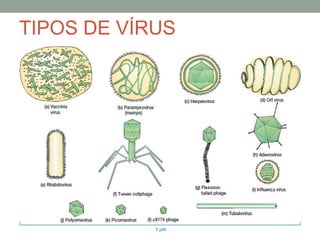TIPOS DE VÍRUS
 