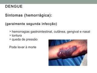DENGUE
Sintomas (hemorrágica):
(geralmente segunda infecção)
 hemorragias gastrointestinal, cutânea, gengival e nasal
 tontura
 queda de pressão
Pode levar à morte
 