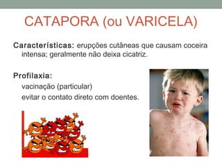 Características: erupções cutâneas que causam coceira
intensa; geralmente não deixa cicatriz.
Profilaxia:
vacinação (particular)
evitar o contato direto com doentes.
CATAPORA (ou VARICELA)
 