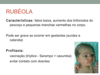 Características: febre baixa, aumento dos linfonodos do
pescoço e pequenas manchas vermelhas no corpo.
Pode ser grave se ocorrer em gestantes (surdez e
catarata)
Profilaxia:
vacinação (tríplice - Sarampo + caxumba)
evitar contato com doentes
RUBÉOLA
 