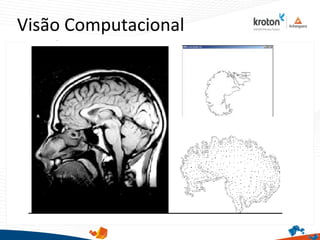 Visão Computacional
 