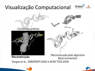 Visualização Computacional
 