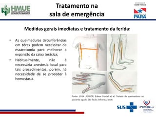 Tratamento na
sala de emergência
Medidas gerais imediatas e tratamento da ferida:
• As queimaduras circunferências
em tórax podem necessitar de
escarotomia para melhorar a
expansão da caixa torácica;
• Habitualmente, não é
necessária anestesia local para
tais procedimentos; porém, há
necessidade de se proceder à
hemostasia.
 