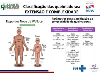 Classificação das queimaduras:
EXTENSÃO E COMPLEXIDADE
Regra dos Nove de Wallace
Parâmetros para classificação da
complexidade de queimaduras
 