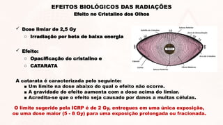 EFEITOS BIOLÓGICOS DAS RADIAÇÕES
Efeito no Cristalino dos Olhos
 Dose limiar de 2,5 Gy
o Irradiação por beta de baixa energia
 Efeito:
o Opacificação do cristalino e
o CATARATA
A catarata é caracterizada pelo seguinte:
■ Um limite na dose abaixo do qual o efeito não ocorre.
■ A gravidade do efeito aumenta com a dose acima do limiar.
■ Acredita-se que o efeito seja causado por danos a muitas células.
O limite sugerido pela ICRP é de 2 Gy, entregues em uma única exposição,
ou uma dose maior (5 - 8 Gy) para uma exposição prolongada ou fracionada.
 