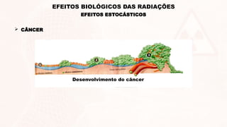  CÂNCER
Desenvolvimento do câncer
EFEITOS ESTOCÁSTICOS
EFEITOS BIOLÓGICOS DAS RADIAÇÕES
 