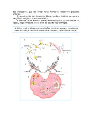 dos merozoítos, que irão invadir novas hemácias, repetindo o processo
anterior.
O rompimento das hemácias libera também toxinas no plasma
sangüíneo, surgindo o acesso malárico.
A malária causa anemia, enfraquecimento geral, graves lesões no
fígado, baço e medula óssea, além de estado de prostração.
A febre terçã maligna provoca lesões cerebrais graves, com fortes
dores de cabeça, ditúrbios sensoriais e motores, convulsões e morte.
 