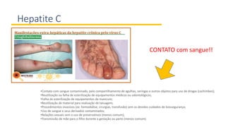 Hepatite C
CONTATO com sangue!!
•Contato com sangue contaminado, pelo compartilhamento de agulhas, seringas e outros objetos para uso de drogas (cachimbos);
•Reutilização ou falha de esterilização de equipamentos médicos ou odontológicos;
•Falha de esterilização de equipamentos de manicure;
•Reutilização de material para realização de tatuagem;
•Procedimentos invasivos (ex: hemodiálise, cirurgias, transfusão) sem os devidos cuidados de biossegurança;
•Uso de sangue e seus derivados contaminados;
•Relações sexuais sem o uso de preservativos (menos comum);
•Transmissão de mãe para o filho durante a gestação ou parto (menos comum).
 