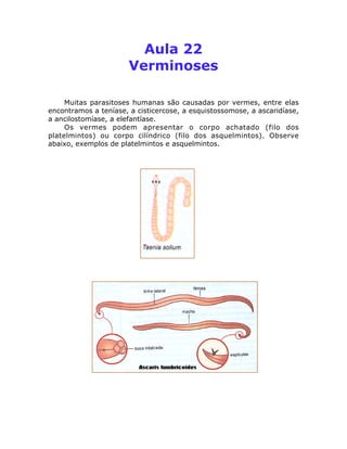 Aula 22
Verminoses
Muitas parasitoses humanas são causadas por vermes, entre elas
encontramos a teníase, a cisticercose, a esquistossomose, a ascaridíase,
a ancilostomíase, a elefantíase.
Os vermes podem apresentar o corpo achatado (filo dos
platelmintos) ou corpo cilíndrico (filo dos asquelmintos). Observe
abaixo, exemplos de platelmintos e asquelmintos.
 