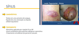 SÍFILIS
Testes em uma amostra de sangue,
líquido de uma ulceração ou líquido
cefalorraquidiano
DIAGNÓSTICO
•Penicilina aplicada por injeção IV ou IM
•Outro antibiótico para pessoas alérgicas à penicilina
•Tratamento simultâneo de parceiros sexuais
TRATAMENTO
 