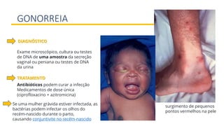 GONORREIA
Exame microscópico, cultura ou testes
de DNA de uma amostra da secreção
vaginal ou peniana ou testes de DNA
da urina
DIAGNÓSTICO
Antibióticos podem curar a infecção
Medicamentos de dose única
(ciprofloxacino + azitromicina)
TRATAMENTO
surgimento de pequenos
pontos vermelhos na pele
Se uma mulher grávida estiver infectada, as
bactérias podem infectar os olhos do
recém-nascido durante o parto,
causando conjuntivite no recém-nascido
 