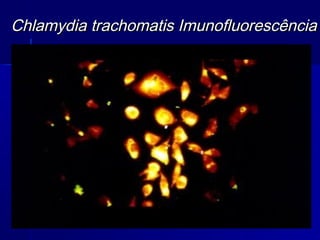 Chlamydia trachomatis Imunofluorescência
 