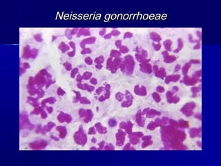 Neisseria gonorrhoeae
 