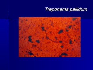 Treponema pallidum
 