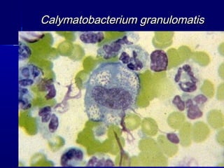 Calymatobacterium granulomatis
 