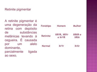 Retinite pigmentar
A retinite pigmentar é
uma degeneração da
retina com depósito
de
substâncias
melânicas levando à
cegueira. É causada
por
um
alelo
dominante,
parcialmente
ligada
ao sexo.

Fenótipo

Homem

Mulher

Retinite

XRYR, XRYr
e XrYR

XRXR e
XRXr

Normal

XrYr

XrXr

 