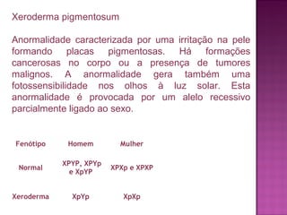 Xeroderma pigmentosum
Anormalidade caracterizada por uma irritação na pele
formando placas pigmentosas. Há formações
cancerosas no corpo ou a presença de tumores
malignos. A anormalidade gera também uma
fotossensibilidade nos olhos à luz solar. Esta
anormalidade é provocada por um alelo recessivo
parcialmente ligado ao sexo.

Fenótipo

Homem

Mulher

Normal

XPYP, XPYp
e XpYP

XPXp e XPXP

Xeroderma

XpYp

XpXp

 