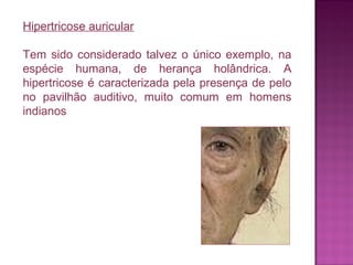 Hipertricose auricular
Tem sido considerado talvez o único exemplo, na
espécie humana, de herança holândrica. A
hipertricose é caracterizada pela presença de pelo
no pavilhão auditivo, muito comum em homens
indianos

 