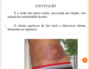 CONTUSÃO
 É a lesão das partes moles, provocada por batida, sem
solução de continuidade da pele.
 O cliente queixa-se de dor local e observa-se edema,
hematoma ou equimose.
 