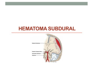 HEMATOMA SUBDURAL
 