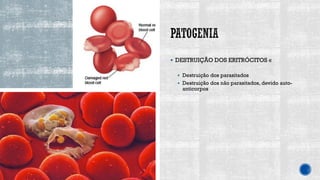▪ DESTRUIÇÃO DOS ERITRÓCITOS «
▪ Destruição dos parasitados
▪ Destruição dos não parasitados, devido auto-
anticorpos
 