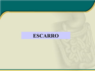 ESCARRO
 