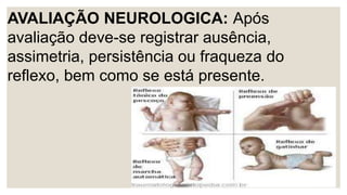 AVALIAÇÃO NEUROLOGICA: Após
avaliação deve-se registrar ausência,
assimetria, persistência ou fraqueza do
reflexo, bem como se está presente.
 