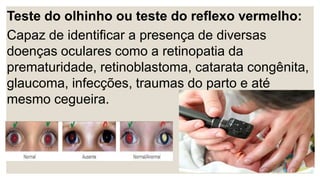 Teste do olhinho ou teste do reflexo vermelho:
Capaz de identificar a presença de diversas
doenças oculares como a retinopatia da
prematuridade, retinoblastoma, catarata congênita,
glaucoma, infecções, traumas do parto e até
mesmo cegueira.
 