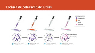 Técnica de coloração de Gram
 