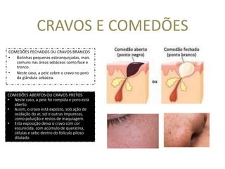 Aula 2 EA- Semiologia, Anamnese e Fotos de Face - 22-2.pptx