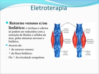 Eletroterapia
Retorno venoso e/ou
linfático: o inchaço e edema
só podem ser reduzidos com a
remoção de fluidos e sólidos da
área, pelos sistemas nervoso e
linfático.
Através de:
- ↑ do retorno venoso;
- ↑ do fluxo linfático;
- Ou da circulação sanguínea.↑
 