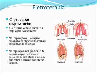 Eletroterapia
O processo
respiratório:
↑ o retorno venoso durante a
inspiração e a expiração;
Na inspiração o Diafragma
pressiona os órgãos abdominais,
pressionando as veias;
Na expiração, um gradiente de
pressão negativa é criado
provocando um efeito de sifão,
que retira o sangue do sistema
venoso.
 