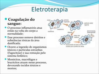 Eletroterapia
Coagulação do
sangue:
O processo inflamatório atua
então na volta do corpo a
normalidade;
Esse processo remove detritos e
substâncias tóxicas da área
danificada;
Ocorre a ingestão de organismos
tóxicos e partículas estranhas
(Fagocitose) e sua remoção pelo
sistema linfático;
Monócitos, macrófagos e
leucócitos atuam nesse processo,
devorando tecidos tóxicos e
mortos;
 