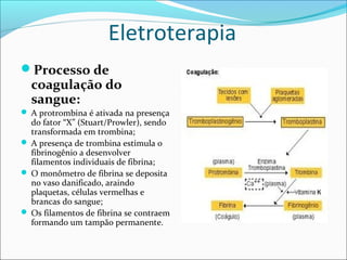 Eletroterapia
Processo de
coagulação do
sangue:
 A protrombina é ativada na presença
do fator “X” (Stuart/Prowler), sendo
transformada em trombina;
 A presença de trombina estimula o
fibrinogênio a desenvolver
filamentos individuais de fibrina;
 O monômetro de fibrina se deposita
no vaso danificado, araindo
plaquetas, células vermelhas e
brancas do sangue;
 Os filamentos de fibrina se contraem
formando um tampão permanente.
 