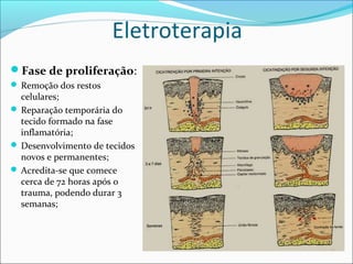 Eletroterapia
Fase de proliferação:
 Remoção dos restos
celulares;
 Reparação temporária do
tecido formado na fase
inflamatória;
 Desenvolvimento de tecidos
novos e permanentes;
 Acredita-se que comece
cerca de 72 horas após o
trauma, podendo durar 3
semanas;
 