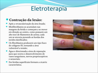 Eletroterapia
Contração da lesão:
 Após a revascularização da área lesada;
 Miofibroblastos se acumulam nas
margens da ferida e começam a se mover
em direção ao centro, como possuem um
alto teor de filamentos de actina; cada
um se encurta puxando as bordas dos
tecidos danificados;
 Os fibroblastos produzem um tipo fraco
de colágeno III, tornando a área
vulnerável a tensão;
 Água e direcionada a área de reparação
para que ocorra o desenvolvimento de
vasos sanguíneos, nervos proprioceptivos
e sensoriais;
 Em feridas superficiais formam a cicatriz
característica.
 