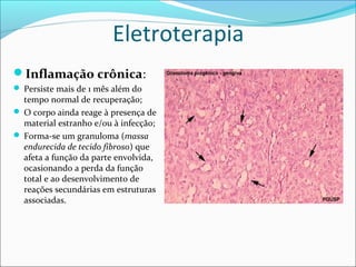 Eletroterapia
Inflamação crônica:
 Persiste mais de 1 mês além do
tempo normal de recuperação;
 O corpo ainda reage à presença de
material estranho e/ou à infecção;
 Forma-se um granuloma (massa
endurecida de tecido fibroso) que
afeta a função da parte envolvida,
ocasionando a perda da função
total e ao desenvolvimento de
reações secundárias em estruturas
associadas.
 