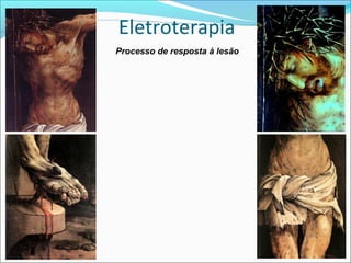 Eletroterapia
Processo de resposta à lesão
 