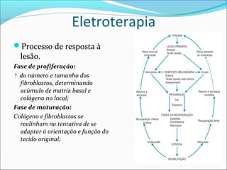 Eletroterapia
Processo de resposta à
lesão.
Fase de profiferação:
↑ do número e tamanho dos
fibroblastos, determinando
acúmulo de matriz basal e
colágeno no local;
Fase de maturação:
Colágeno e fibroblastos se
realinham na tentativa de se
adaptar à orientação e função do
tecido original;
 