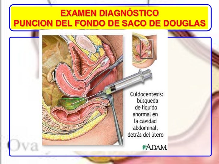El dolor en el cuello en la parte izquierda