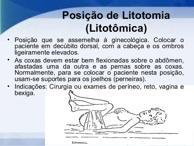 Posicoes de exames