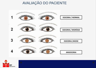 ISOCORIA / NORMAL
ISOCORIA / MIDRÍASE
ISOCORIA /MIOSE
ANISOCORIA
AVALIAÇÃO DO PACIENTE
 