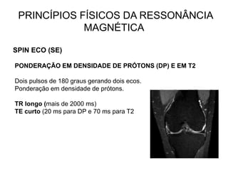 PRINCÍPIOS FÍSICOS DA RESSONÂNCIA
MAGNÉTICA
SPIN ECO (SE)
PONDERAÇÃO EM DENSIDADE DE PRÓTONS (DP) E EM T2
Dois pulsos de 180 graus gerando dois ecos.
Ponderação em densidade de prótons.
TR longo (mais de 2000 ms)
TE curto (20 ms para DP e 70 ms para T2
 
